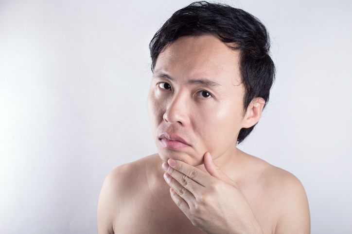 大人メンズが気をつけたい肌荒れの症状