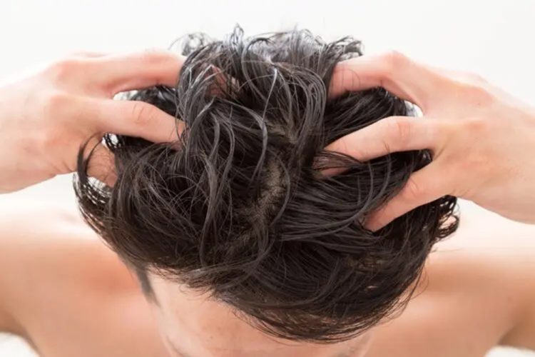 フケの対策方法