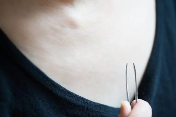 乳毛の間違った対処法