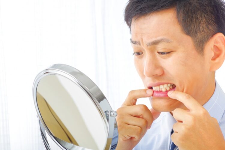 ホワイトニングのデメリット