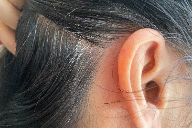 白髪のメカニズム