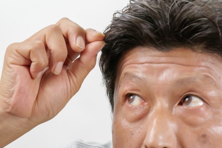 白髪の進行を抑える方法