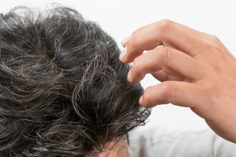 白髪を抜くと増えるのは本当？